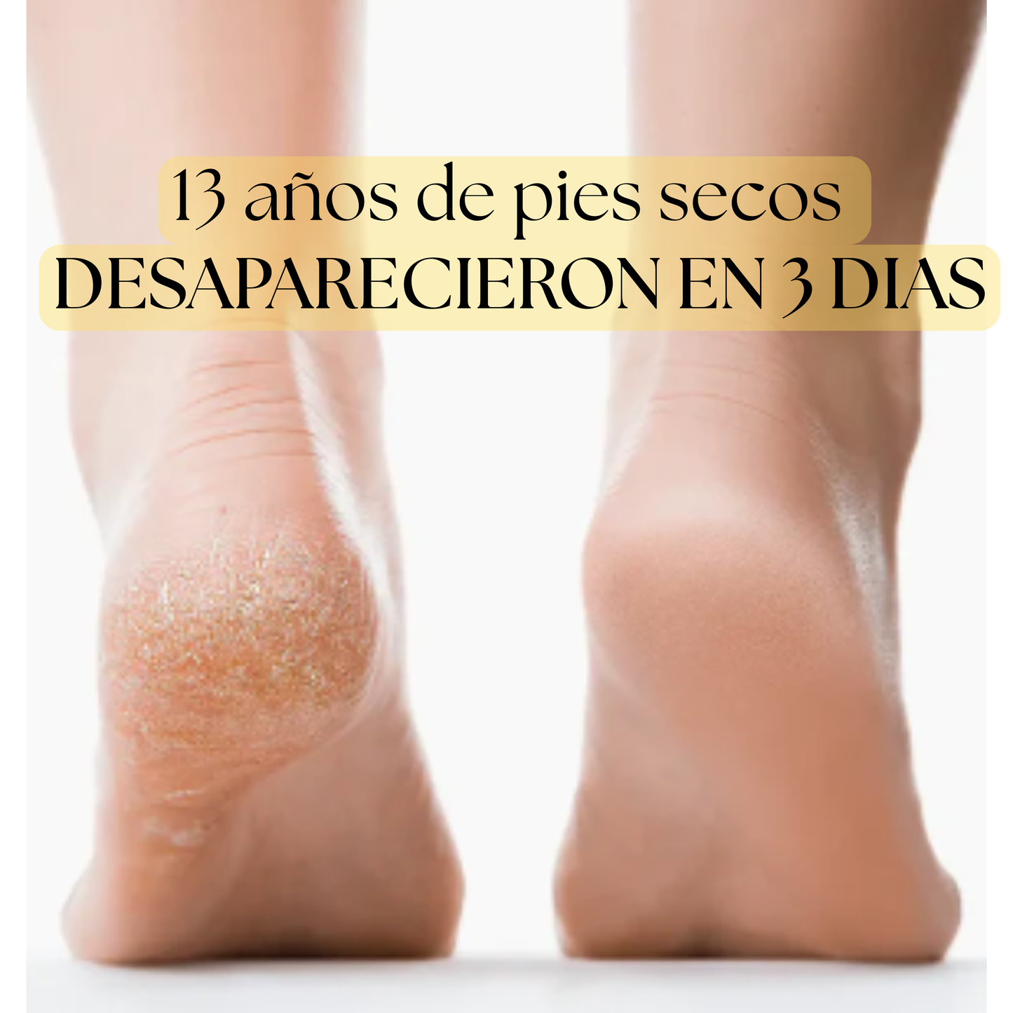 Envio gratis